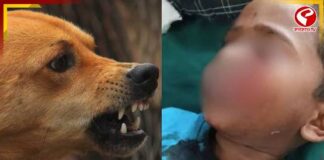 ফের পথকুকুরের হামলা! ৪ বছরের শিশুকে ছিঁড়ে খেল ২৫টি জন্তু