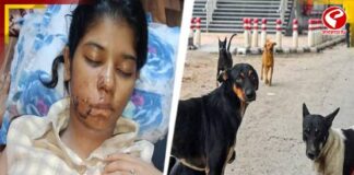 কুকুরের আক্রমণে ক্ষতবিক্ষত তরুণী, ১৭টি সেলাই পড়ল মুখে