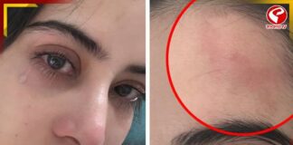 ঠোঁটের পর এবার কপাল! ফের চর্চায় উরফি