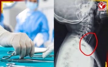 গলায় অস্ত্রোপচার, পিন বের করে শিশুর প্রাণরক্ষা KMCH-এর ডাক্তারদের