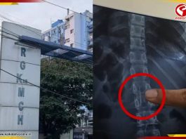 চুলের পিন গলায় গেঁথে বিপত্তি! ডাক্তারের দক্ষতায় প্রাণরক্ষা কিশোরীর