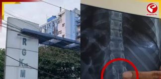 চুলের পিন গলায় গেঁথে বিপত্তি! ডাক্তারের দক্ষতায় প্রাণরক্ষা কিশোরীর