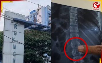 চুলের পিন গলায় গেঁথে বিপত্তি! ডাক্তারের দক্ষতায় প্রাণরক্ষা কিশোরীর