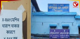আলিপুরদুয়ার হাসপাতালে বন্ধ ডিজিটাল এক্স-রে পরিষেবা, ভোগান্তি