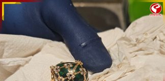 ১৭ লক্ষ টাকার পেনডেন্ট গিলে ফেলল যুবক! তার পর…