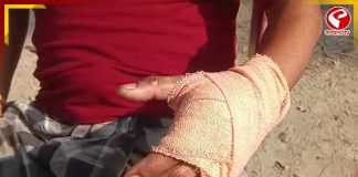 বোমায় ঝলসে গেল তৃণমূলকর্মীর হাত, ফের উত্তপ্ত ভাঙড়