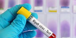 চিকিৎসায় সাড়া দিচ্ছেন আক্রান্ত দুই নার্স