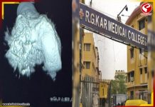 হাড় প্রতিস্থাপনে নজির গড়ল RG Kar, সফল অস্ত্রোপচারে বড় সাফল্য
