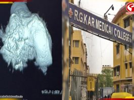 হাড় প্রতিস্থাপনে নজির গড়ল RG Kar, সফল অস্ত্রোপচারে বড় সাফল্য