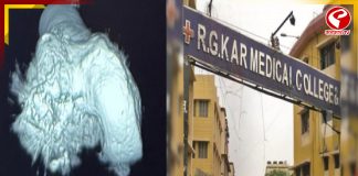 হাড় প্রতিস্থাপনে নজির গড়ল RG Kar, সফল অস্ত্রোপচারে বড় সাফল্য