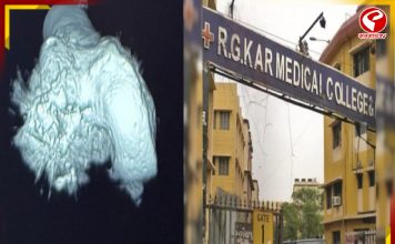 আরজি কর কাণ্ডে ভিসেরা নমুনা বিকৃতির অভিযোগ, সিবিআই তদন্তের নির্দেশ শিয়ালদহ আদালতের