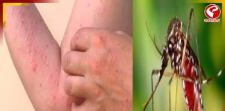 ফের চিকুনগুনিয়ার আতঙ্ক কেরলে! নির্দেশ অমান্য করলে ১০ হাজার টাকা জরিমানা