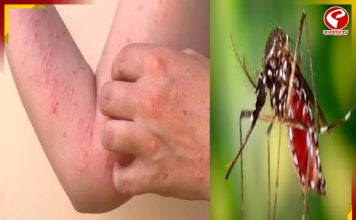 ফের চিকুনগুনিয়ার আতঙ্ক কেরলে! নির্দেশ অমান্য করলে ১০ হাজার টাকা জরিমানা